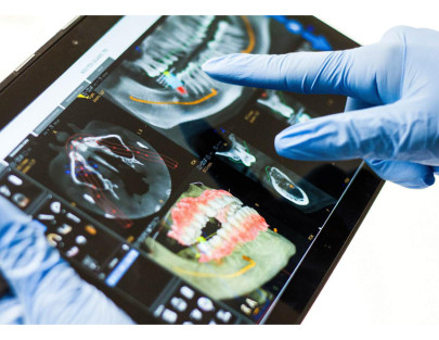 Dr. Aymen Arad - Dental implants with Guided Surgery: Fast and effective solutions for our patients