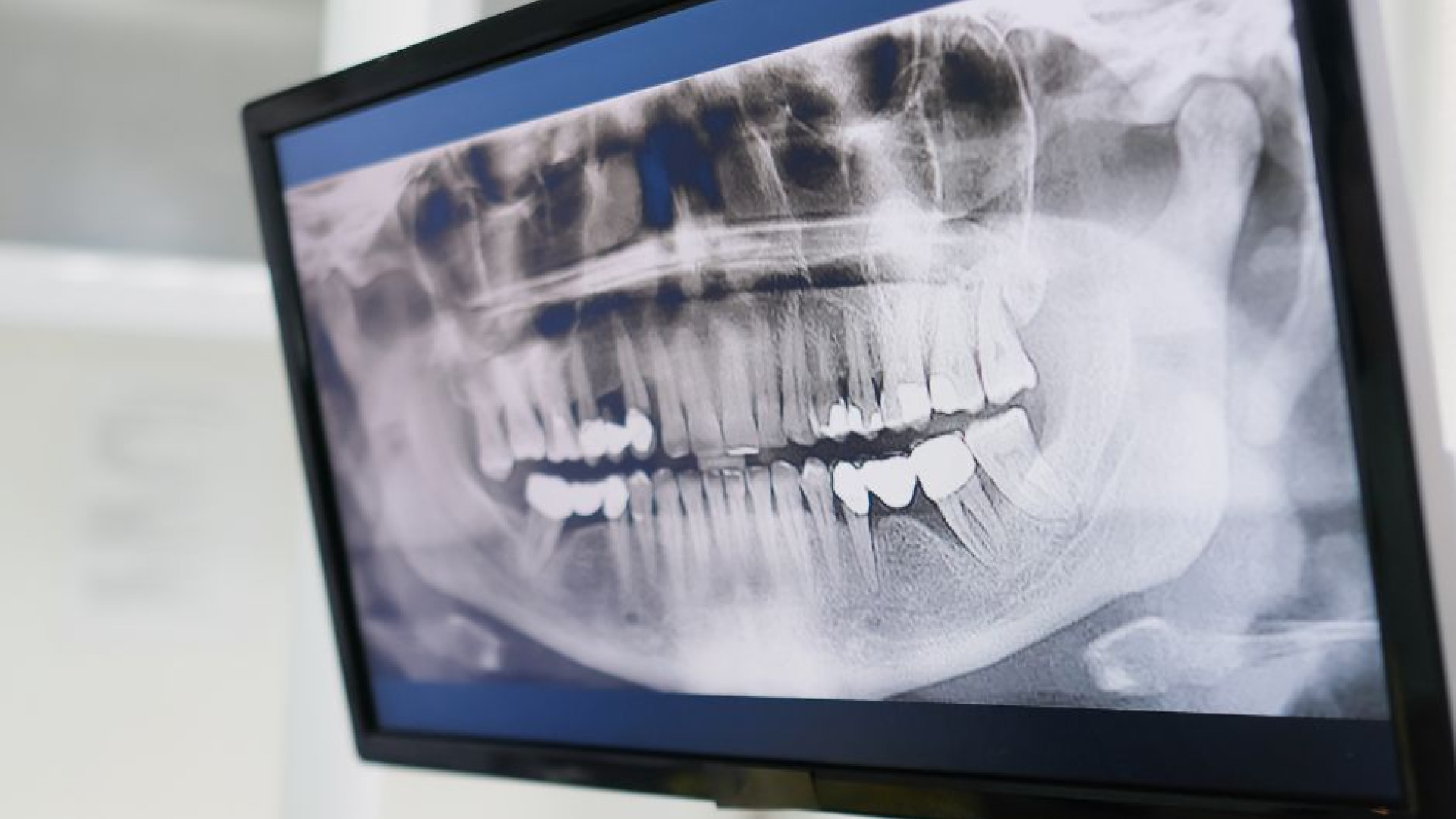 Dr. Aymen Arad - Avantajele chirurgiei ghidate digital în implantologie